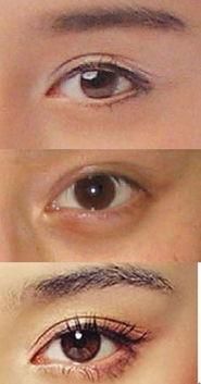 怎么整容成为明星的,揭秘如何通过整容迈向璀璨星途